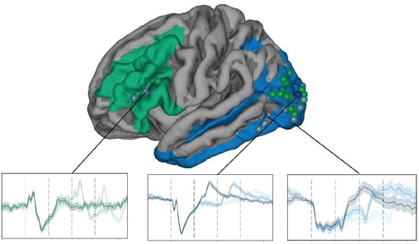 Study turns up new clues, new questions in the search for the roots of consciousness